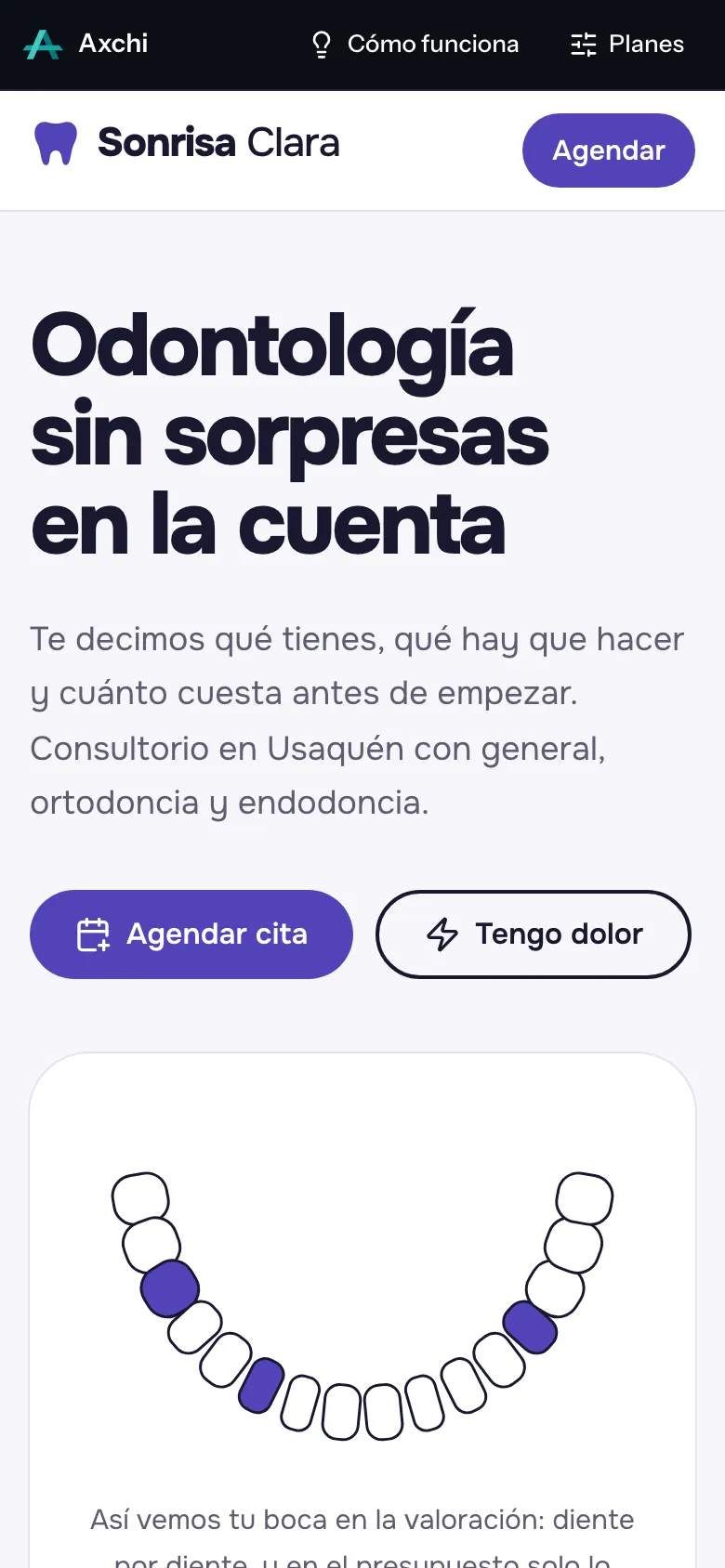 Portada de la demo de Sonrisa Clara en un celular